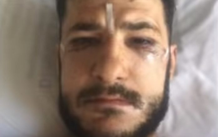 Depois de dizerem que nunca mais andaria, um ano após acidente consegue recuperar Depois de dizerem que nunca mais andaria, um ano após acidente consegue recuperar