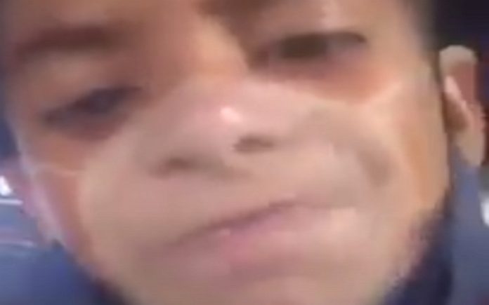 Menino fica com marca de máscara na cara depois de ida à praia