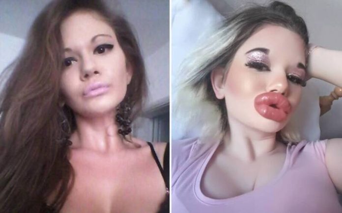 Andrea Ivanova transforma o seu rosto em 'Barbie humana' com mais de 30 injeções labiais