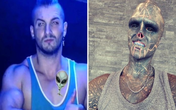 Viciado em tatuagem tem pele esculpida na cabeça para tatuar o seu 'nickname'