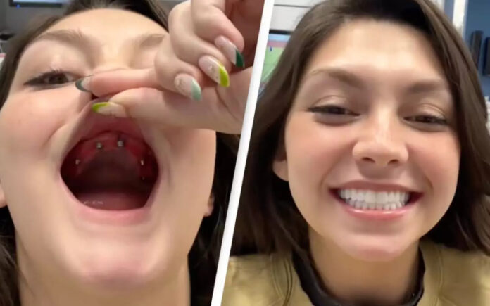 Mulher mostra incrível processo de obter _novos dentes_ que está a deixar as pessoas em lágrimas Mulher mostra incrível processo de obter _novos dentes_ que está a deixar as pessoas em lágrimas