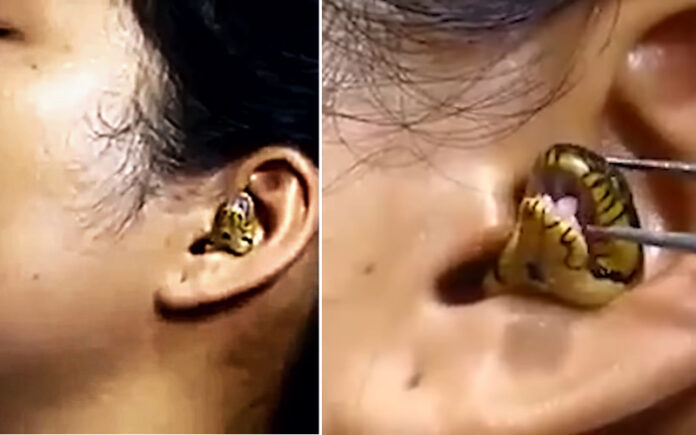 O momento viral em que um doutor lutou para conseguir remover uma cobra viva no ouvido de uma mulher O momento viral em que um doutor lutou para conseguir remover uma cobra viva no ouvido de uma mulher