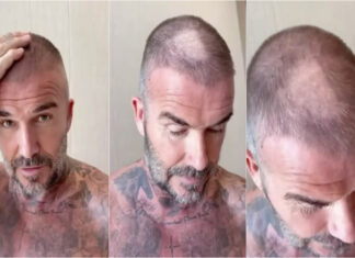 David Beckham sofre acidente com máquina de cortar cabelo e recebe gozo da esposa