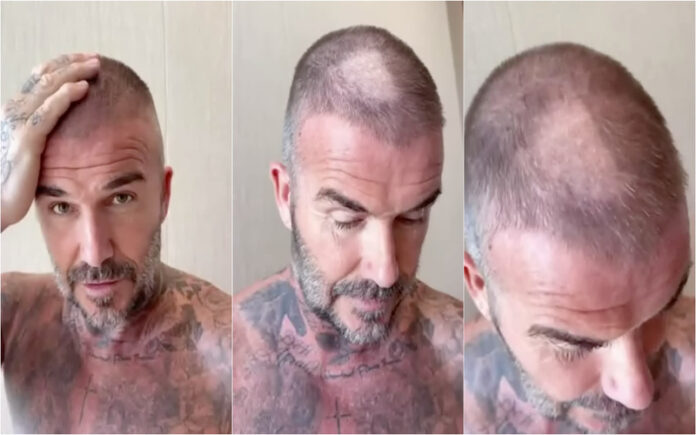 David Beckham sofre acidente com máquina de cortar cabelo e recebe gozo da esposa