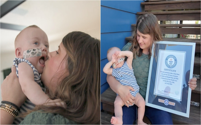 Bebé mais prematuro do mundo celebra o primeiro ano: Uma história de esperança